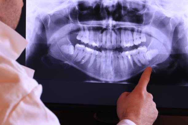 Best Cosmetic Emergency Dentistry in Lodi, OH