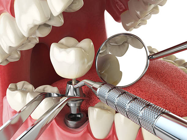 Best Cosmetic Emergency Dentistry in Lodi, OH