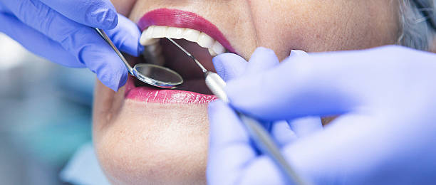 Best Emergency Dental Care for Broken or Chipped Teeth in Lodi, OH